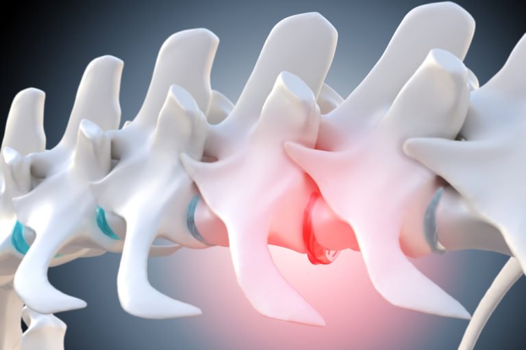 best orthopaedics treatment in indore