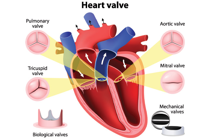 Heart Valve Surgery Causes, Replacement and Types