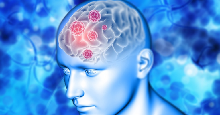 neurology hospital in Indore