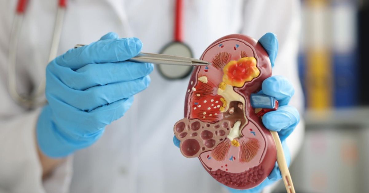 Advanced Urological Care for a Healthier Tomorrow