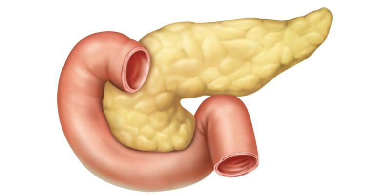 pancreas, general surgery hospital in indore